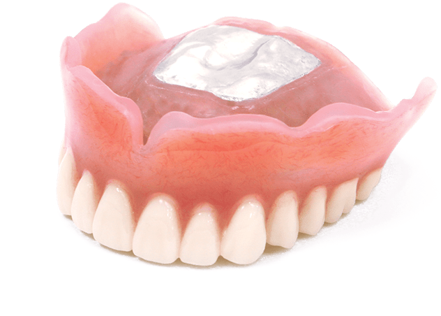 自費の入れ歯の種類